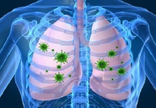 راه های پیشگیری از عفونت های تنفسی در فصل زمستان