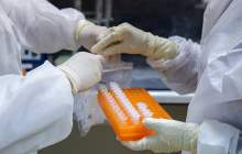 انجام روزانه 80 آزمایش PCR در چهارمحال و بختیاری/ محدودیتی در انجام نمونه‌گیری از افراد مشکوک به کرونا وجود ندارد