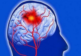بیماری پارکینسون ریسک سکته را افزایش می دهد