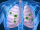 راه های پیشگیری از عفونت های تنفسی در فصل زمستان
