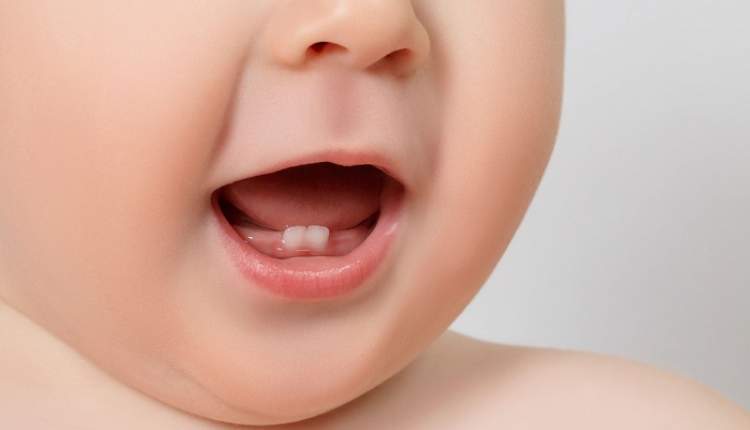 لزوم حفظ دندان شیری کودکان برای جایگزینی دندان‌های دائمی