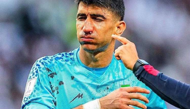 جام جهانی فوتبال| اعلام آخرین وضعیت مصدومیت بیرانوند و جلسه اضطراری تیم ملی در نیمه‌شب!
