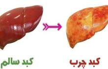 کبد چرب، بیماری خاموش اما کشنده