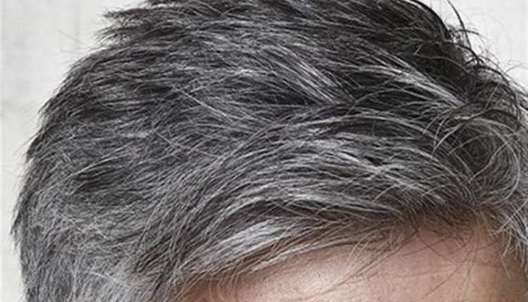 سردی مزاج علت سفیدی موی زودرس