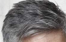 سردی مزاج علت سفیدی موی زودرس